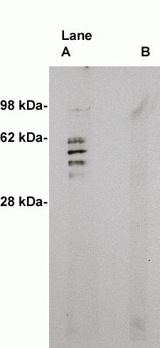  Western blot on human brain lysate (10 ug/lane) using Exalpha’s X2059P antibody to Sphingomyelin Synthase 2 (0.5 ug/ml). Lane A] 1 ug/ml antibody alone, lane B] antibody plus 3 ug blocking peptide. Blot was developed with Pierce’s Super Sytem West Femto - 1 minute exposure.